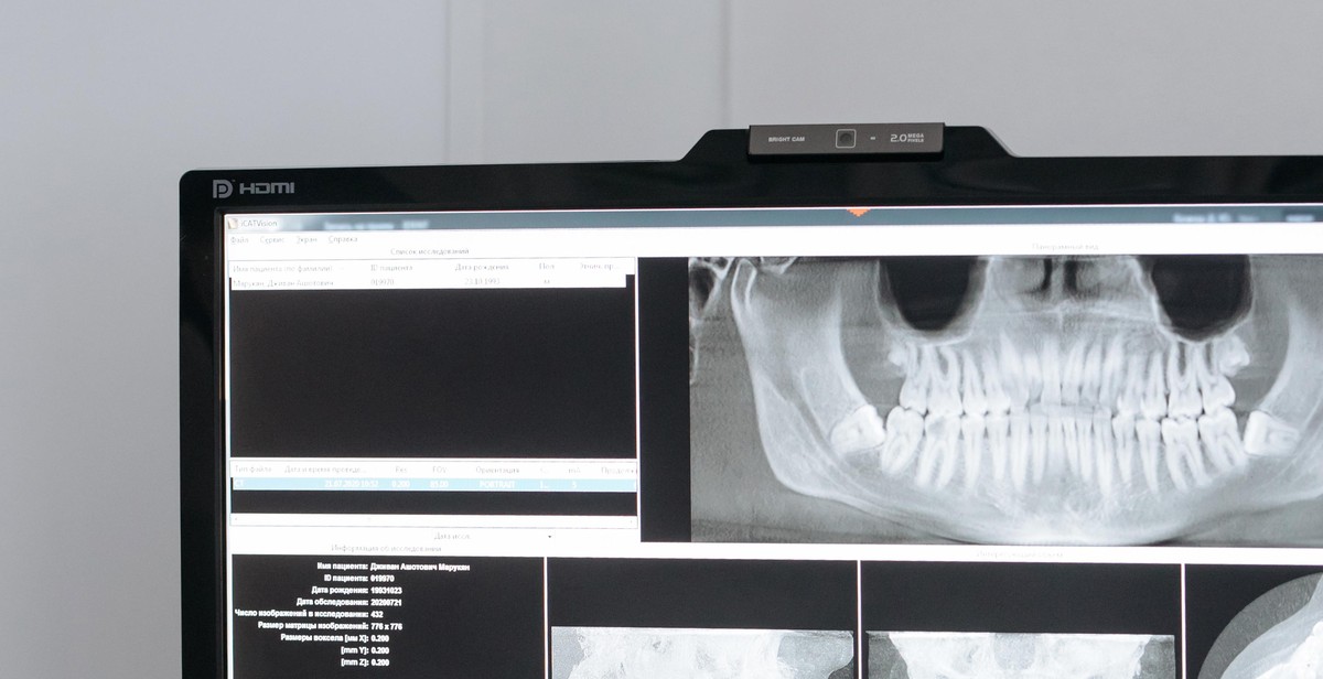 calibrating dental x-ray equipment