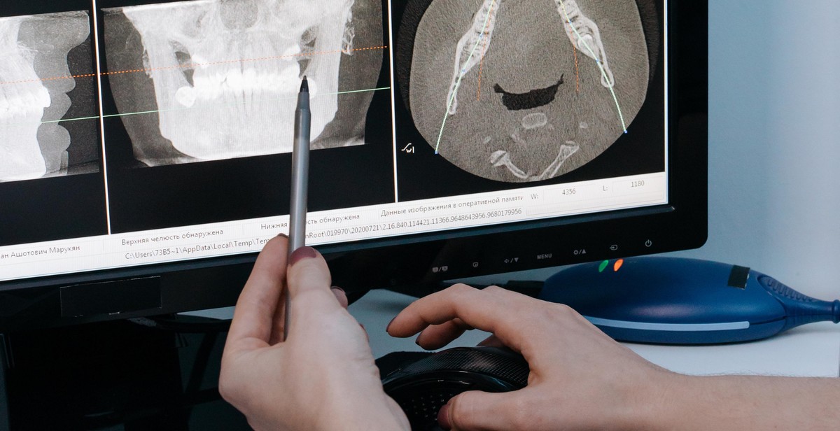 dental x-ray equipment calibration frequency