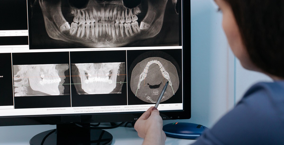 dental x-ray in progress