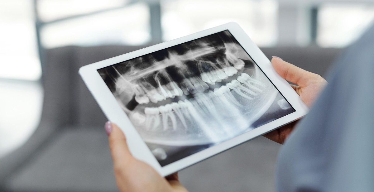 different types of dental x-rays