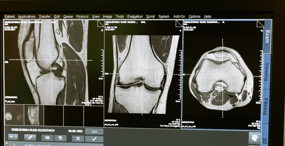 x-ray examination preparation